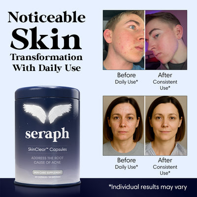 SkinClear™ Capsules