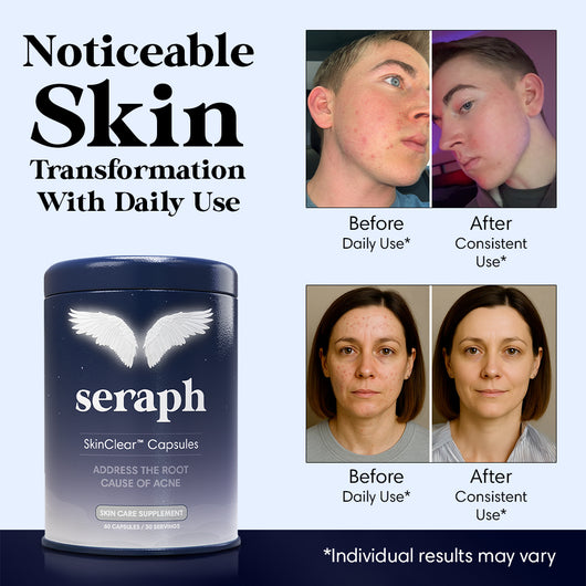 SkinClear™ Capsules